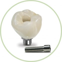 Implant-Thumbnail